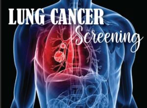 Lung Cancer Screening - Hackensack Radiology